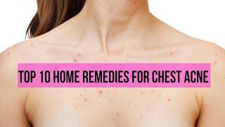 Top 10 Home Remedies For Chest Acne