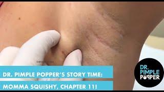 Dr. Pimple Popper's Weekly Story Time: Momma Squishy, Chapter 11