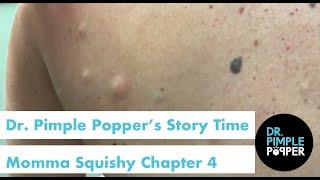 Dr. Pimple Popper's Weekly Story Time: Momma Squishy, Chapter 4