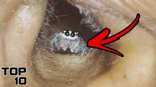 Top 10 People Who Had Creatures Living In Their Ears