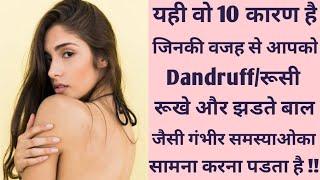 Dandruff reasons।। Top 10 reasons of Dandruff and Hair fall problem।।Kya hai Dandruff/रूसी ke karan?