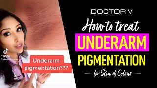 Doctor V - How To Treat Underarm Pigmentation For Skin Of Colour | Brown Or Black Skin | #shorts