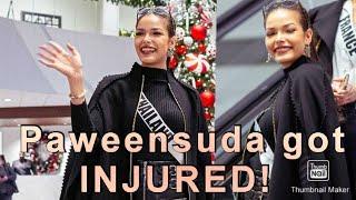 LOOK! Miss Universe Thailand 2019 GOT HER RIGHT EYE INJURED!