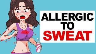 Allergic to Sweat | My Horrible Life