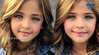 Top 10 Most Unique Features And Beautiful Kids In The World