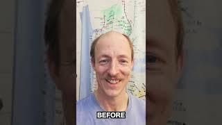 Man Going Bald Instantly Shaves 10 YEARS Off His Age