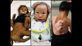 Top 10 People born with extra Body parts 2020 | Viral video